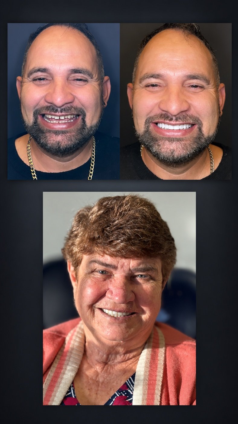 Colagem de sorrisos de pacientes da Coralli